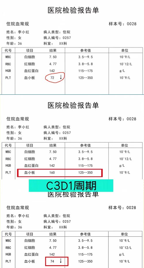 AE與研究藥物關(guān)系記錄不一致，如何處理？